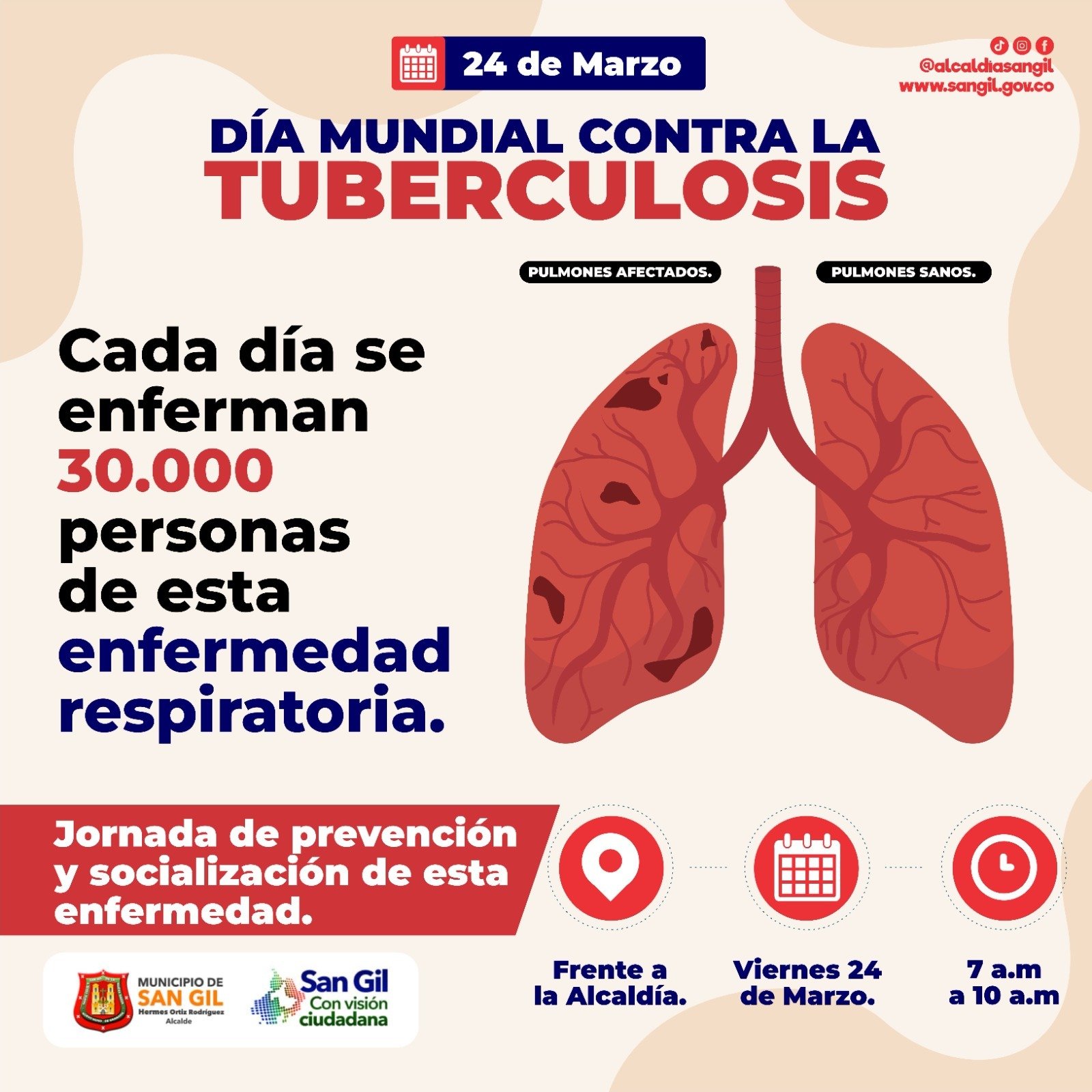 Día Mundial Contra La Tuberculosis La Cometa Radio